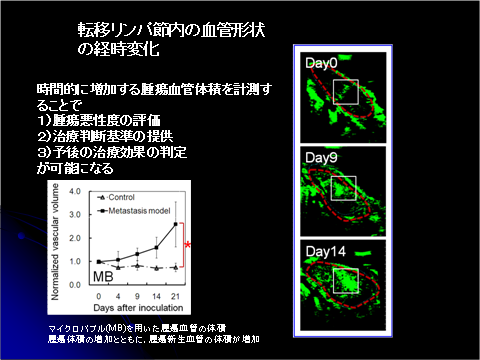 転移リンパ節内の血管形状の経時変化